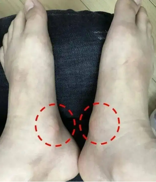 \